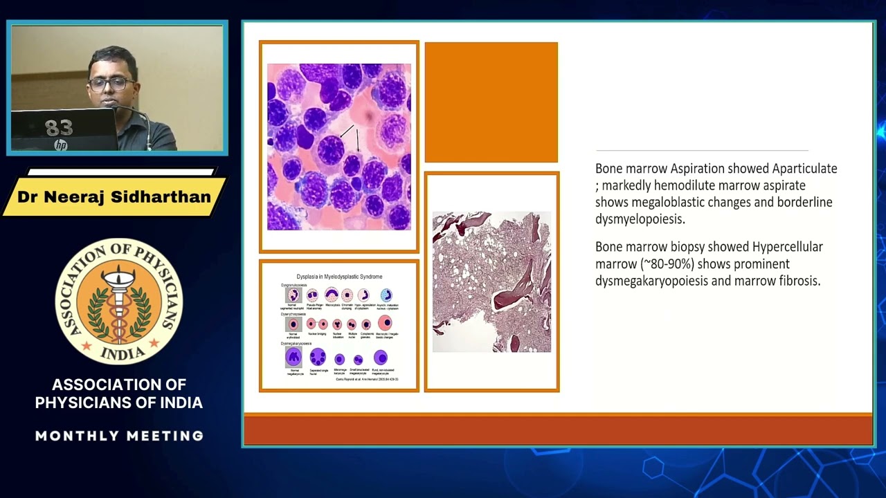 APPROACH TO PATIENTS WITH PANCYTOPENIA (MAY 2023)