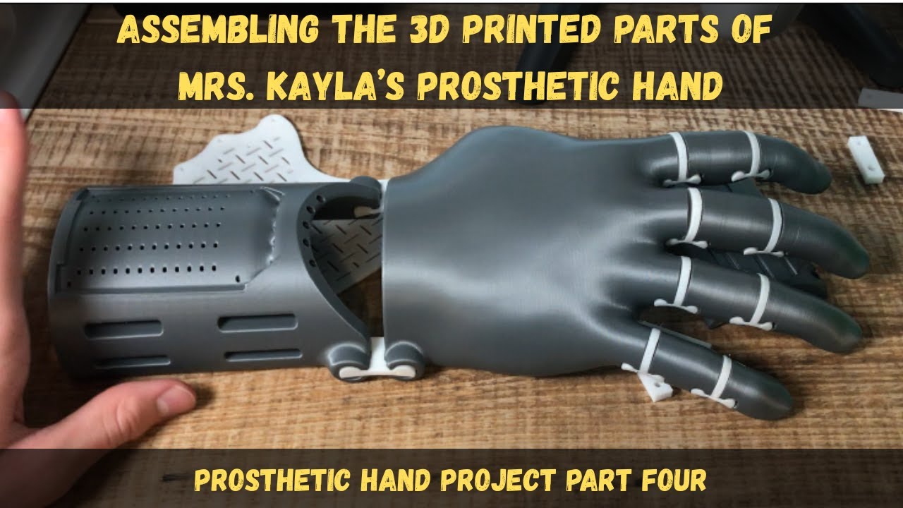 Assembling the 3D printed parts of Mrs. Kayla's prosthetic hand/ Prosthetic hand project part four