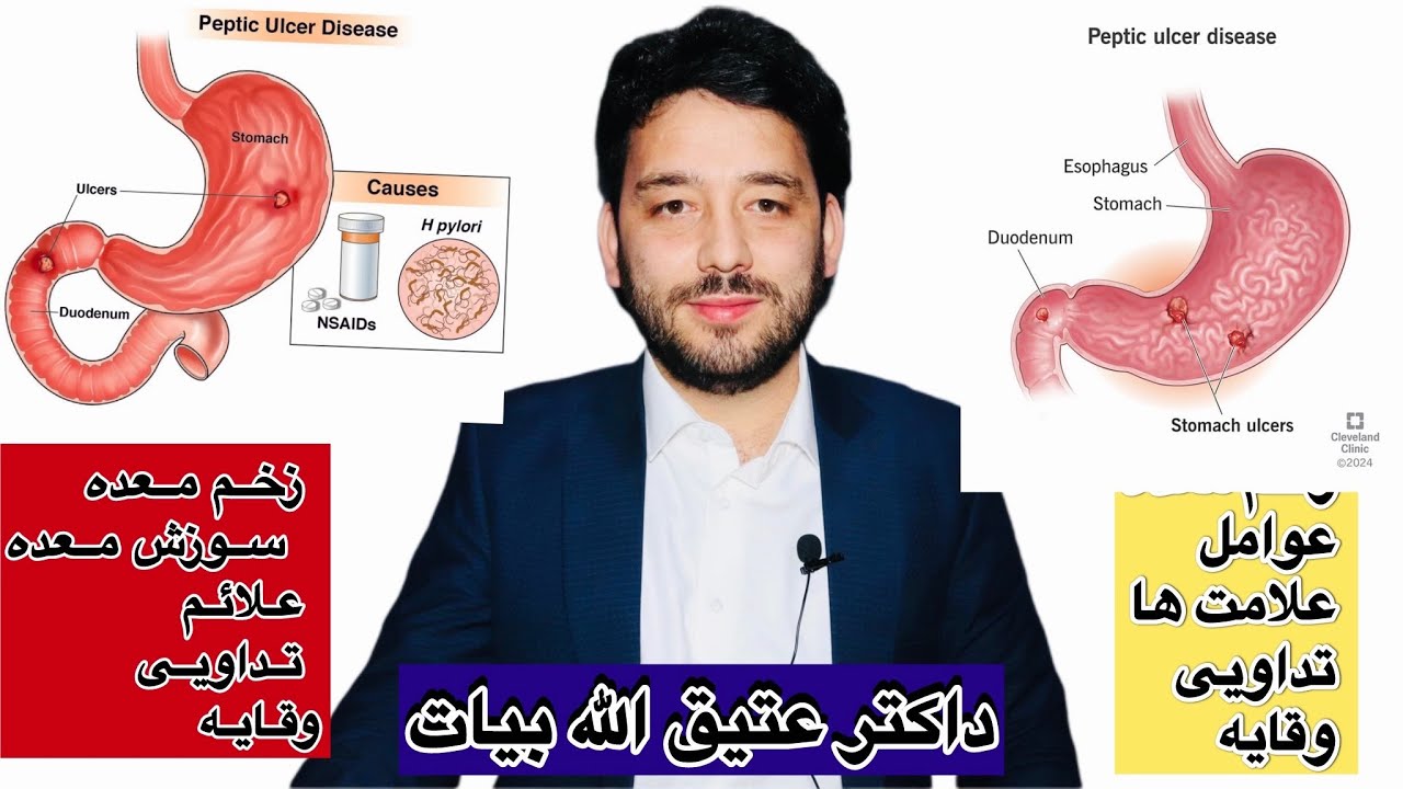 زخم معده چیست؟ | علائم، علل، تشخیص و درمان کامل زخم معده علائم خطرناک #shorts #pepticulcer