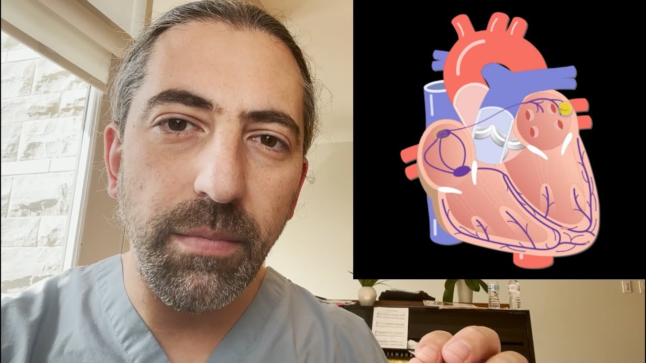 Patient Education: What is Atrial Fibrillation