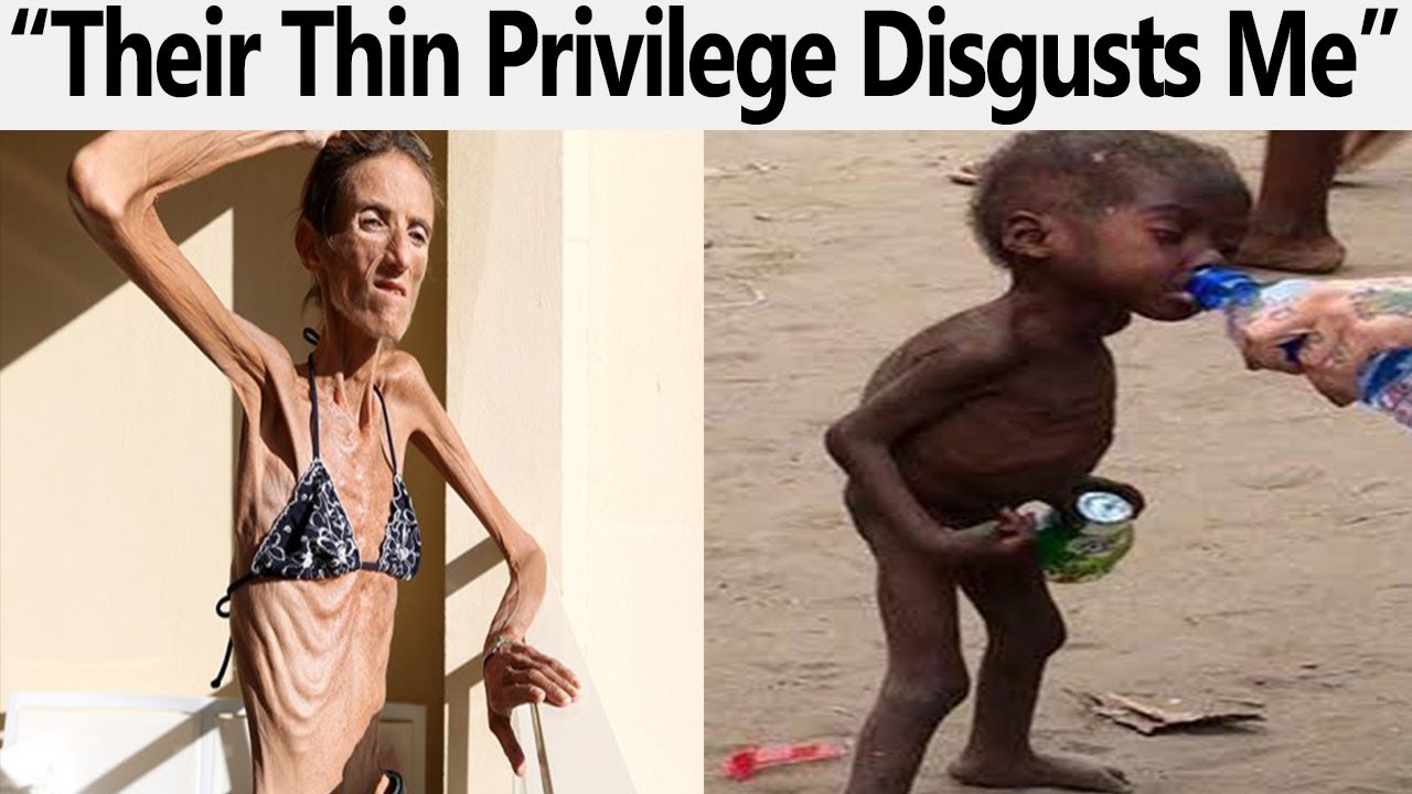 r/FatLogic | Life's Not Fair I Want Their Thin Privilege