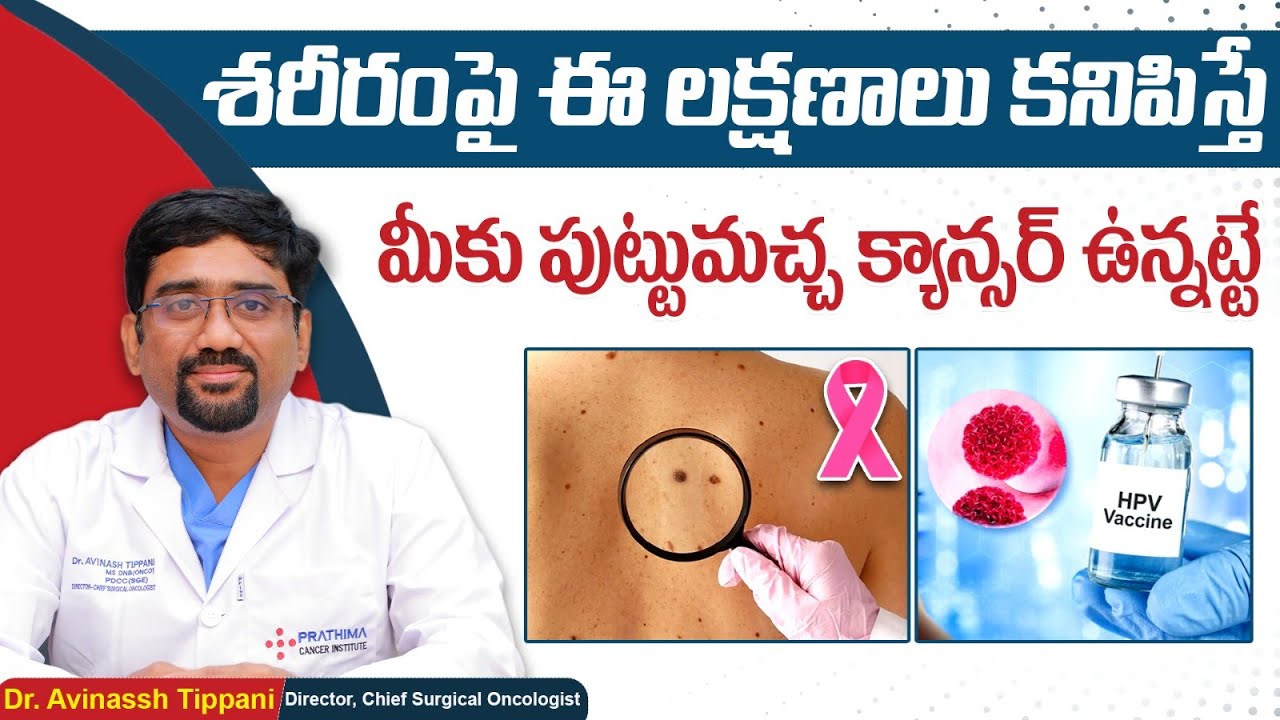 Signs and Symptoms of Skin Cancer Melanoma || Skin Cancer in Telugu || Prathima Cancer Institute