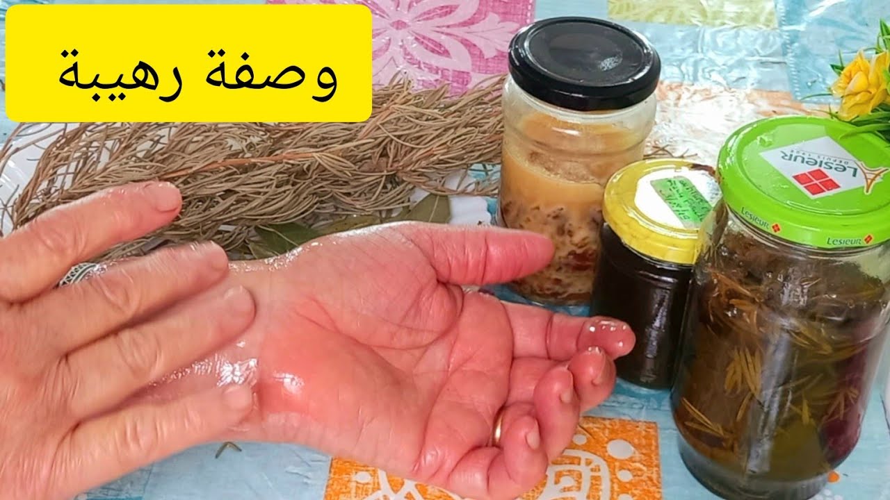 سبب المرض ديالي😪باش راني مريضة⁉️خلطة جبارة👌لجميع مشاكل العضام المفاصل وخشونة الركبة