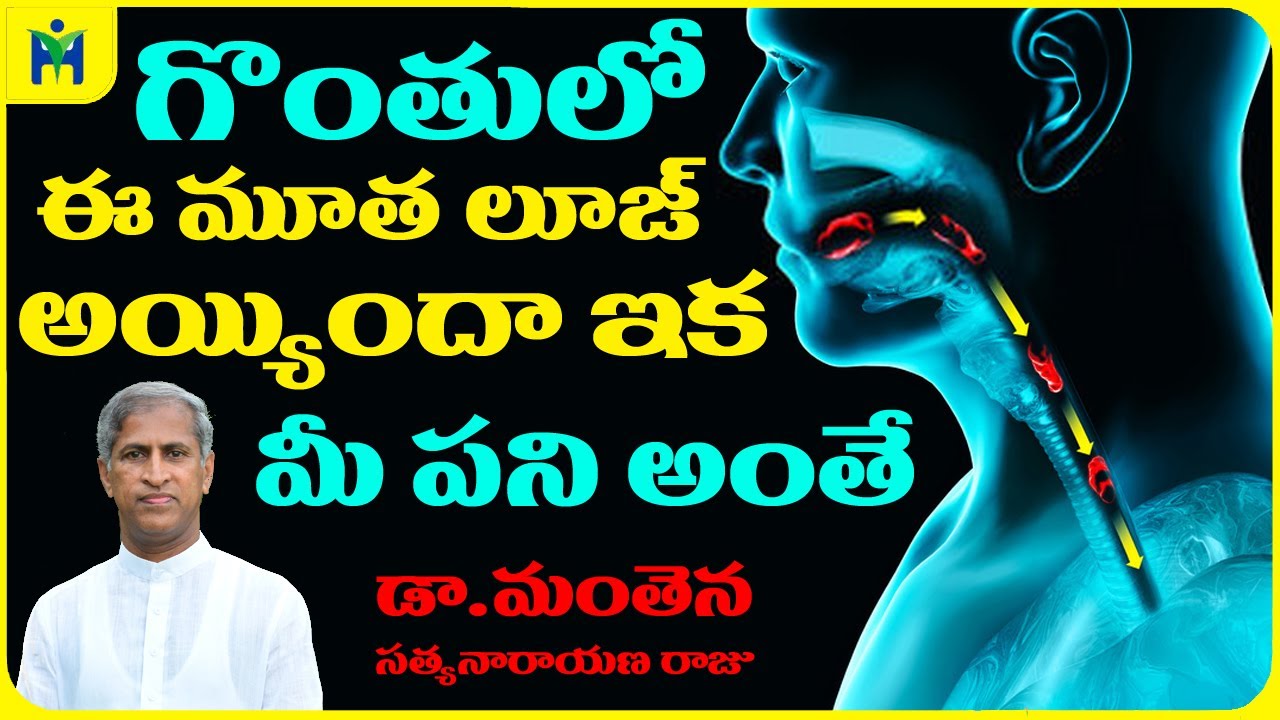Esophagus Sphincter | గొంతులో ఈ మూత లూజ్ అయ్యిందా మీ పని ఇక అంతే ? | Dr Manthena Satyanarayana Raju