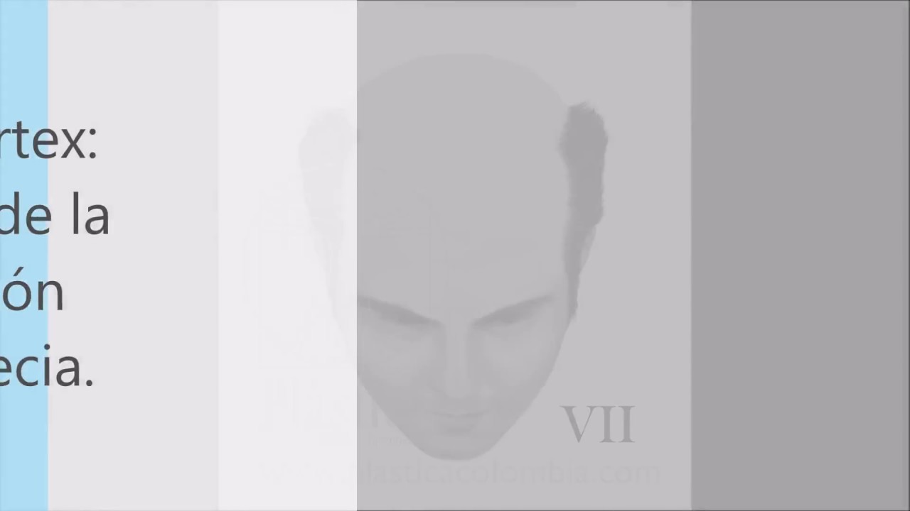 Tipo de calvicie en hombres / Clasificaci&oacute;n alopecia  / Tratamientos en injerto de pelo