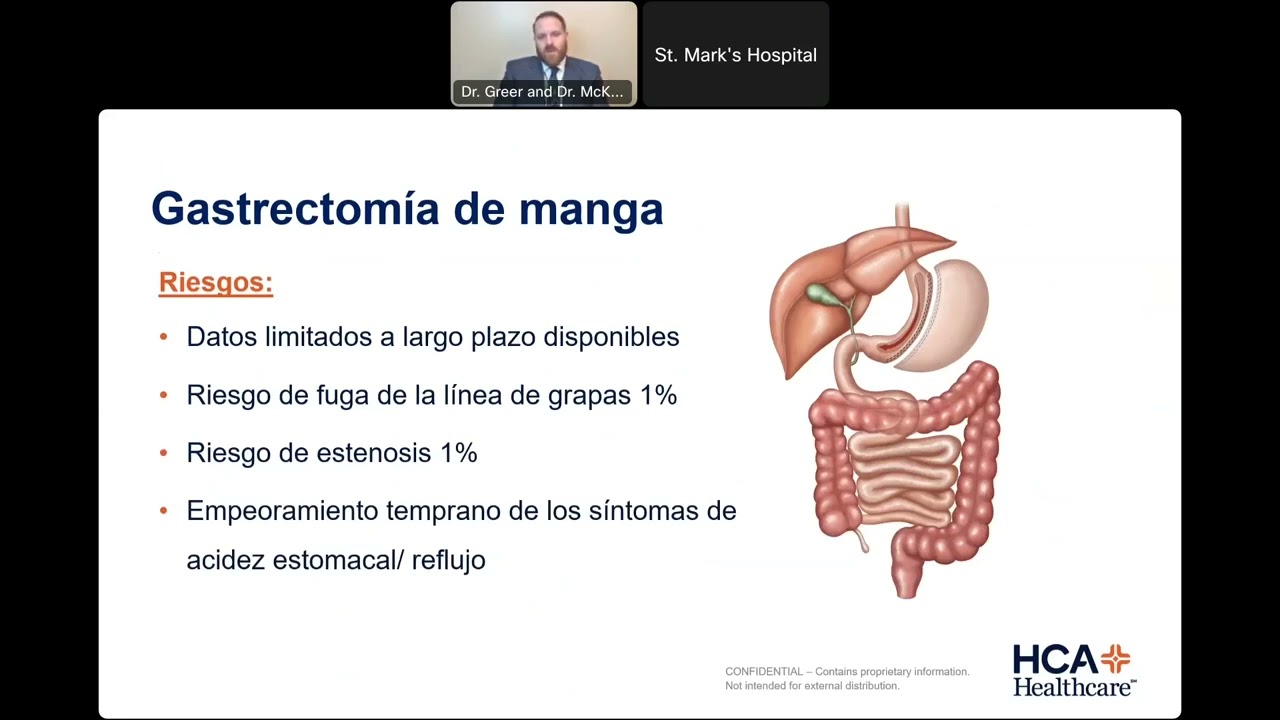 Clase de información en línea sobre cirugía para bajar de peso - St. Mark's Hospital