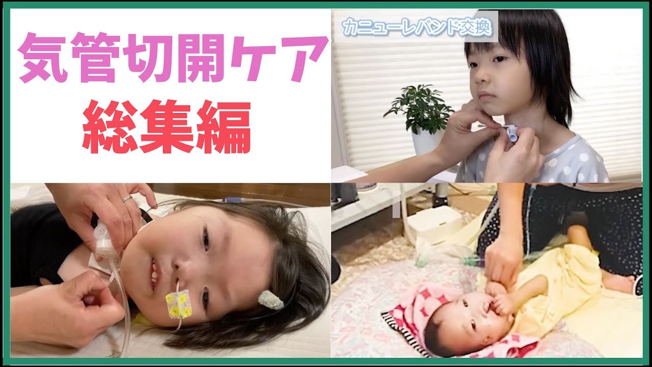 【一挙公開！】気管切開とは？/バンド交換/カニューレ交換/吸引