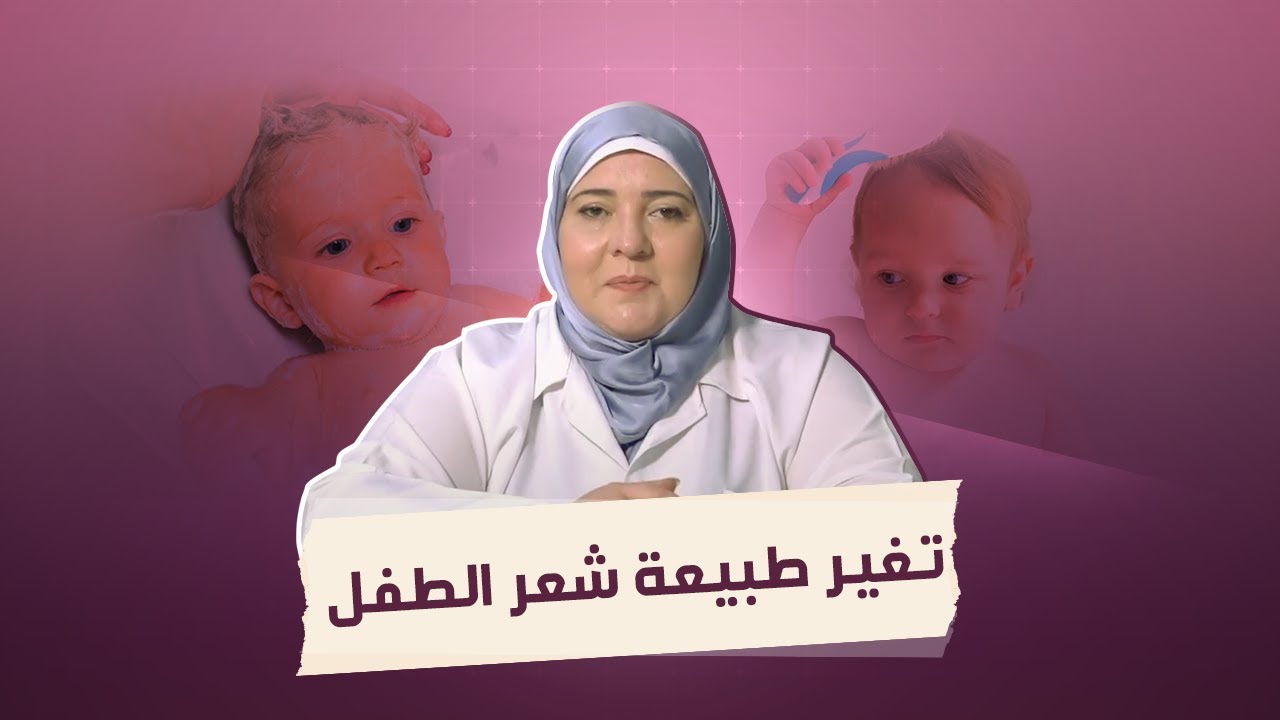 دكتور مامي | تغير طبيعة شعر الطفل