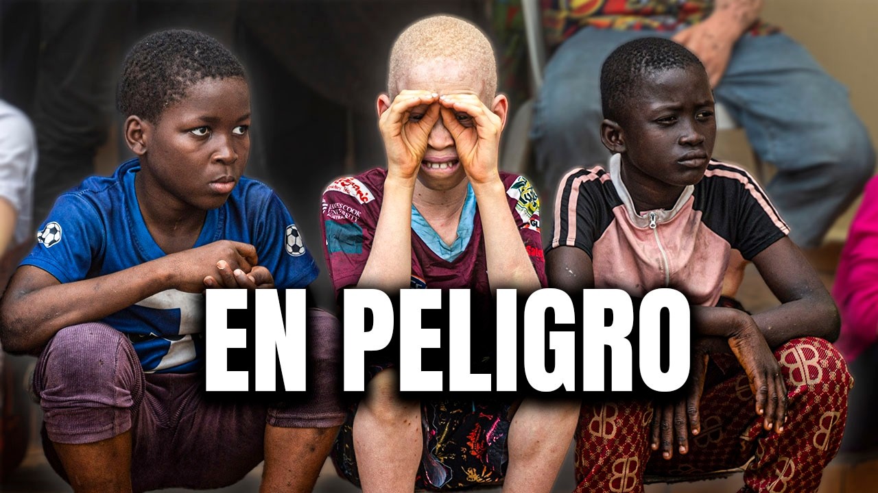 Lo que nadie dice del albinismo en &Aacute;frica