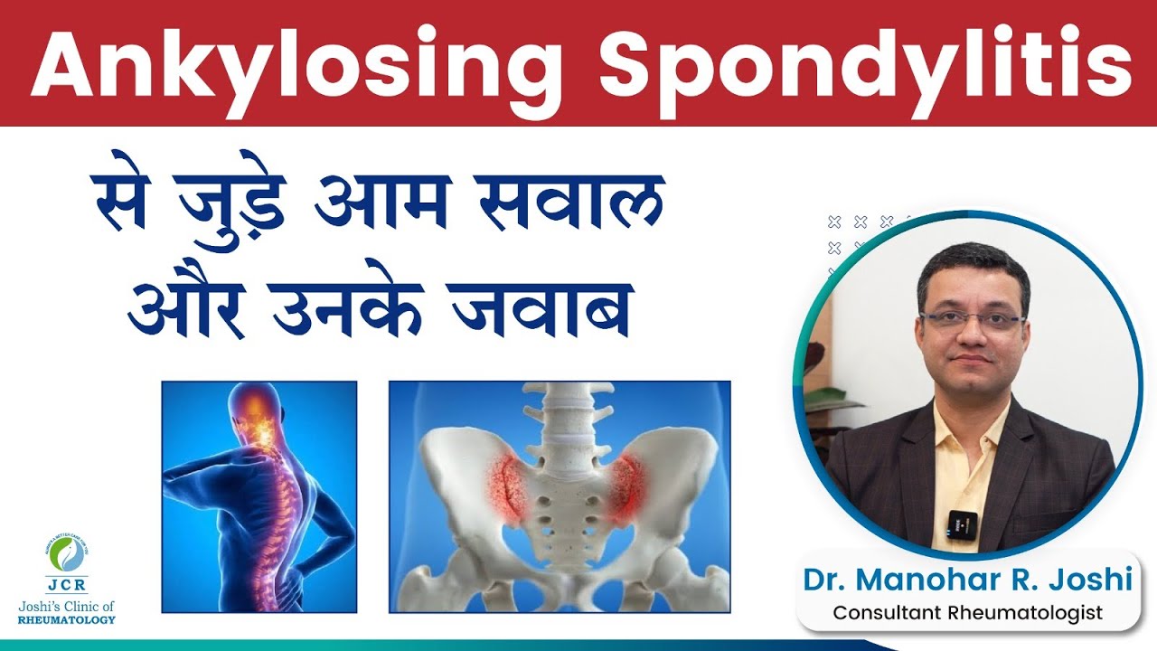 Ankylosing Spondylitis से जुड़े आम सवाल और उनके जवाब | Dr Manohar Joshi