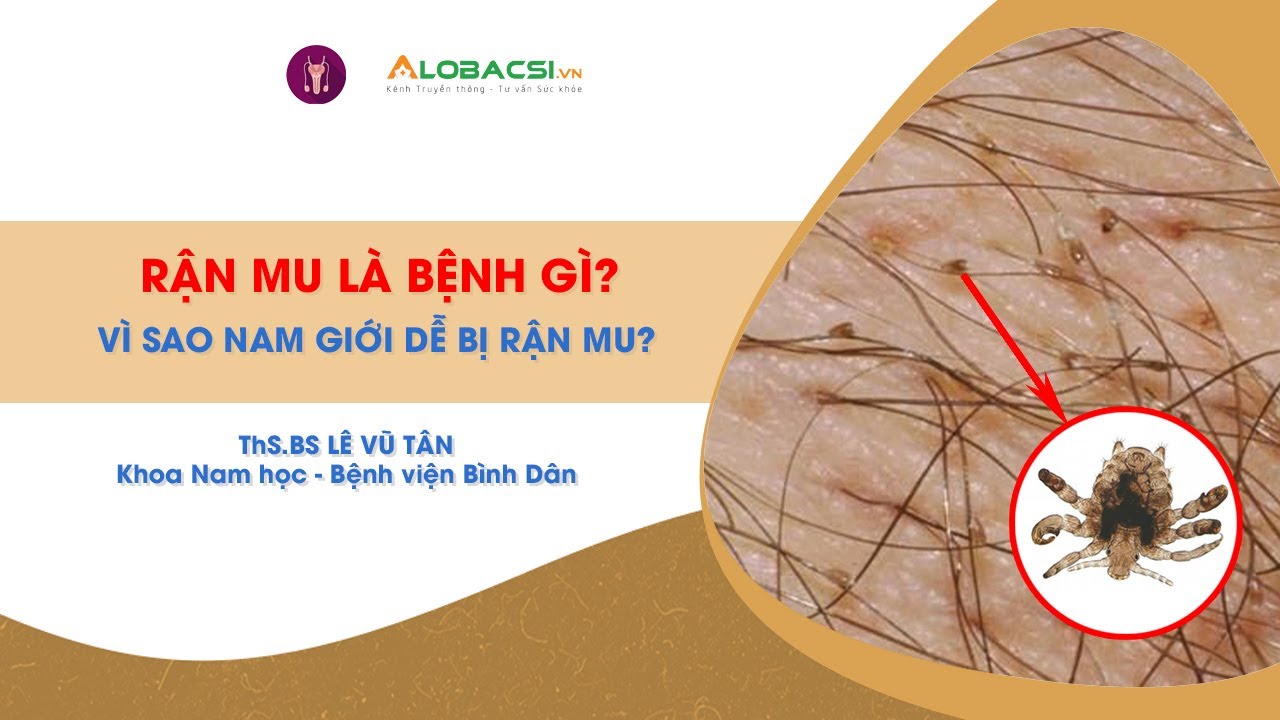 Rận mu l&agrave; bệnh g&igrave;? V&igrave; sao nam giới lại dễ bị rận mu?