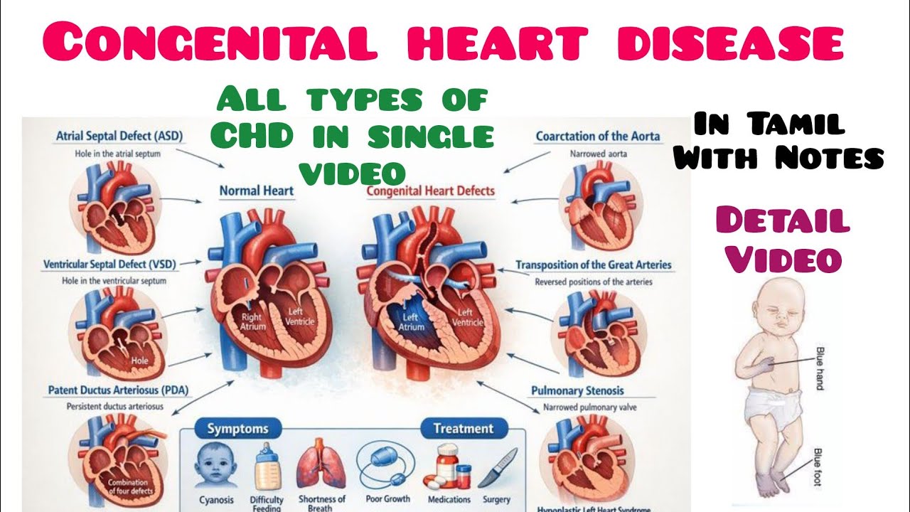 All Congenital Heart Diseases in One Video | Types, Shunts & Management in Tamil #physio #notes