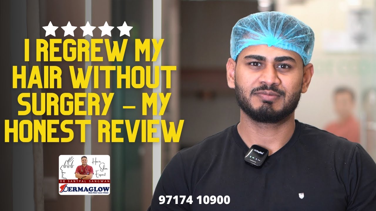 I Regrew My Hair Without Surgery! My Honest PRP + GFC Experience in Gurugram | Dr. Santpal Sangwan