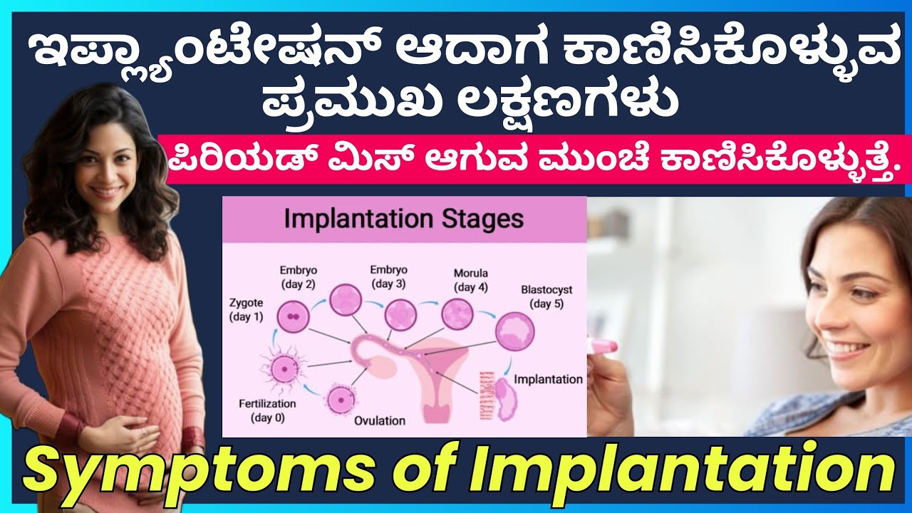 Symptoms of Implantation | ಇಪ್ಲ್ಯಾಂಟೇಷನ್ ಆದಾಗ ಕಾಣಿಸಿಕೊಳ್ಳುವ  ಪ್ರಮುಖ ಲಕ್ಷಣಗಳು