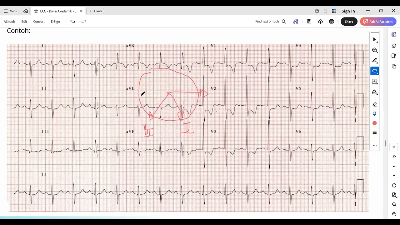 Konsep ECG - Divisi Akademik 24 - Alim - Part 2
