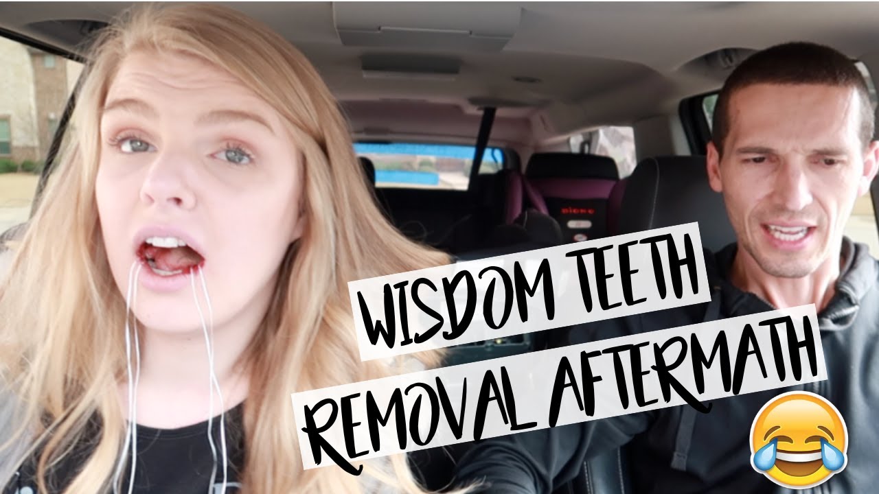 WIFE GETS HER WISDOM TEETH REMOVED 2019 |  AFTERMATH WILL MAKE YOU LAUGH