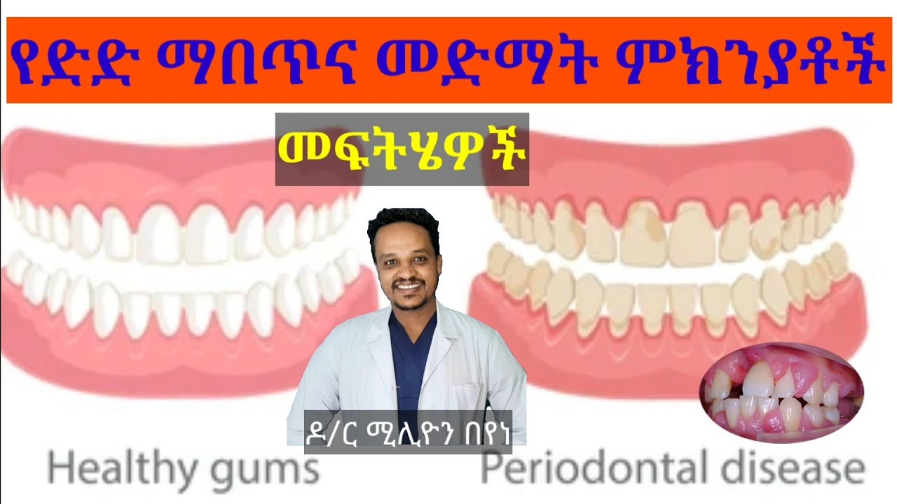 ድዳችን ለምን ያብጣል ይደማል? ምክንያቶችና መፍትሄው@ዶርሚሊዮንDrMillion
