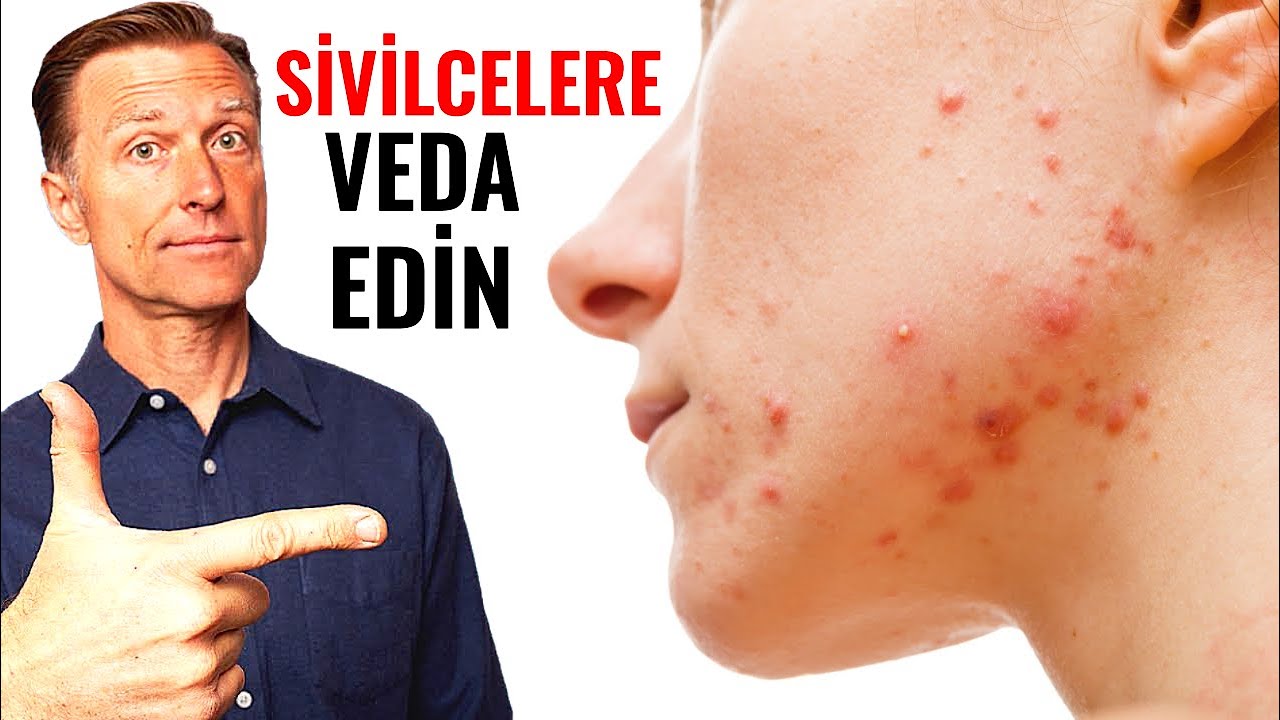 Sivilcelere Son Verin: Kalıcı Y&ouml;ntemlerle | Dr.Berg T&uuml;rk&ccedil;e