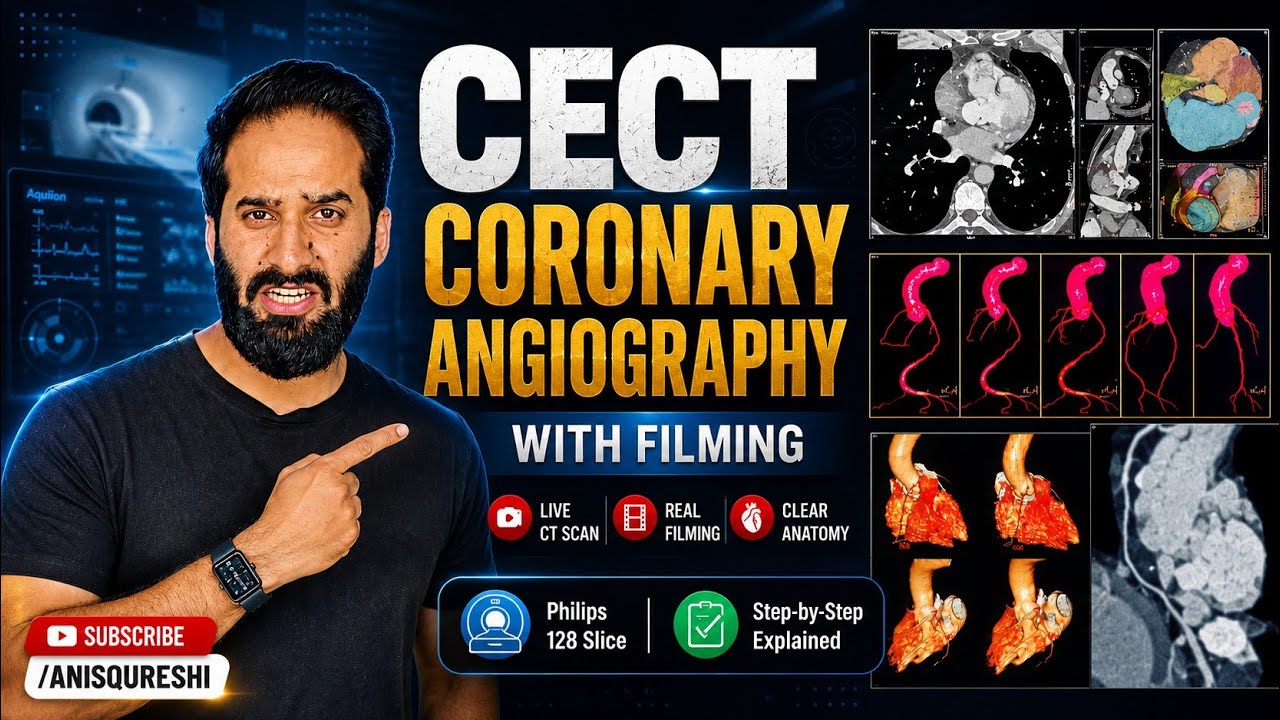 CECT Coronary Angiography With Filming | By Anis Qureshi