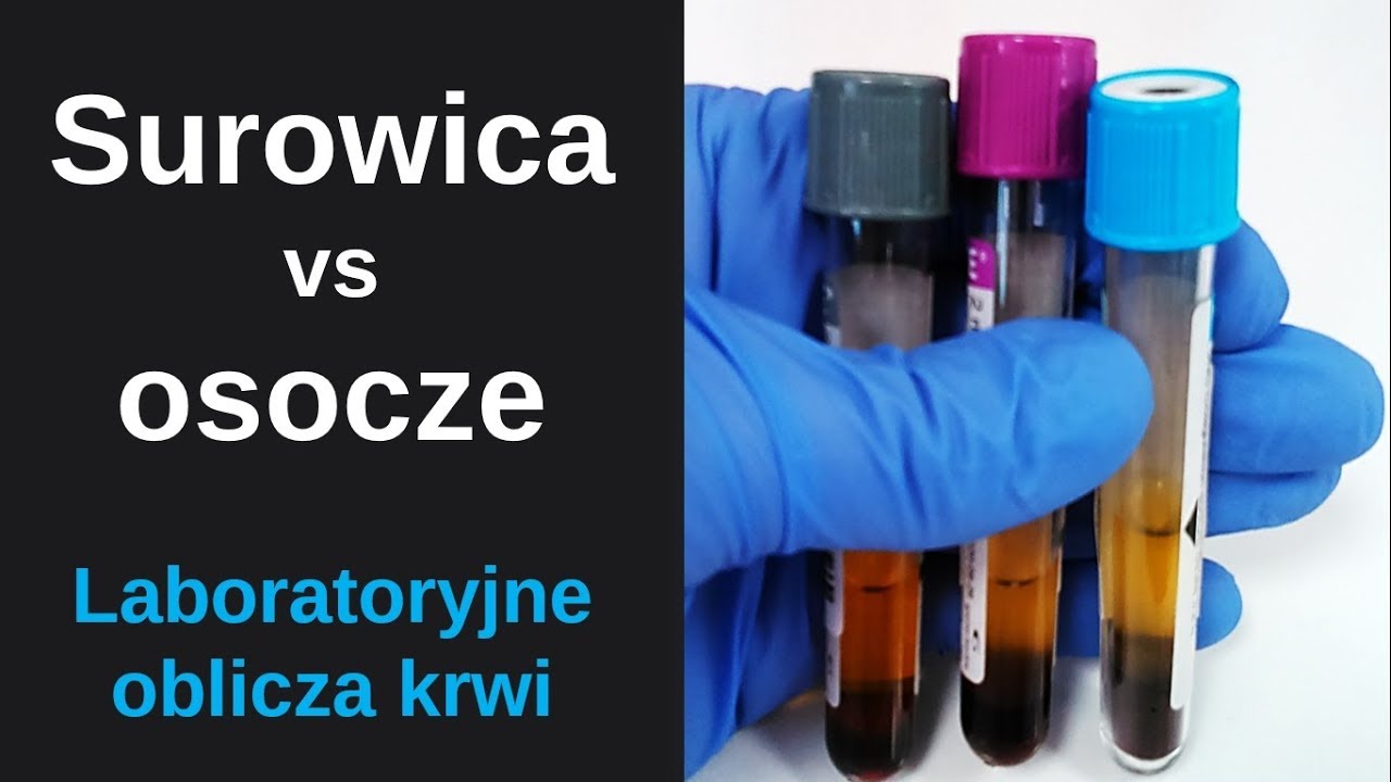Surowica a osocze - właściwości i różnice. Czy wybór ma znaczenie ? | Serum and plasma