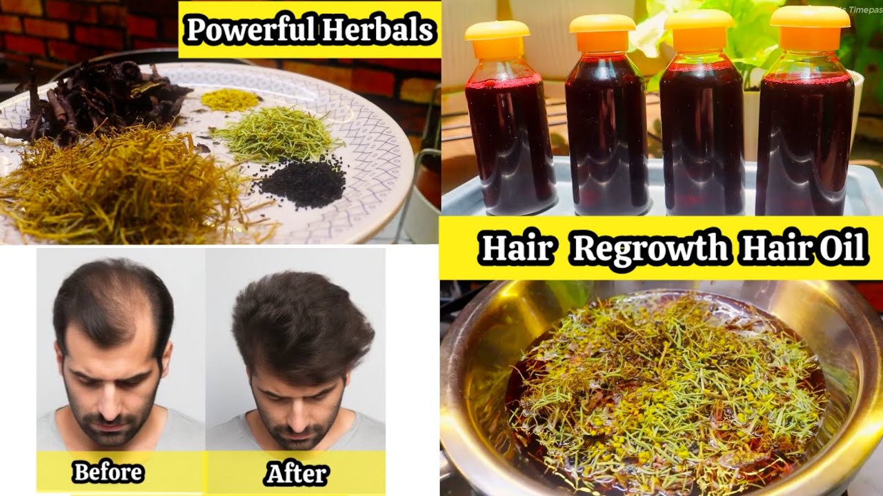 நம்ப முடியாத அளவுக்கு முடி வளரும் #haircaretips #hairoilforgrowth #rosemaryhairoil #hairgrowthtips