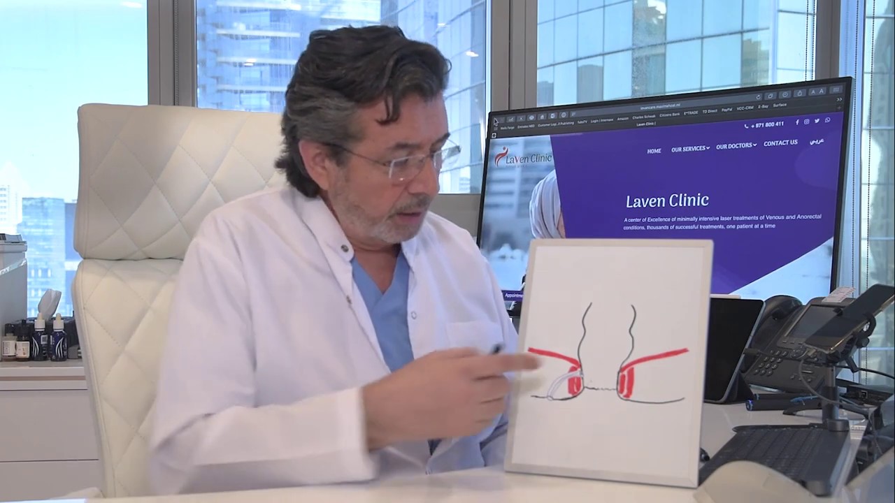 Fistula Arabic SA علاج الناسور بالليزرعيادة لافين التخصصية