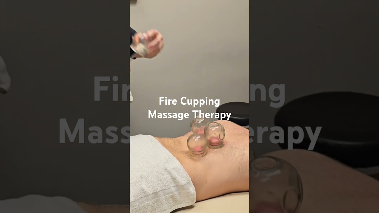 Fire Cupping for Pain Relief &ndash; Fast & Powerful Technique! #cupping #painrelief #massage