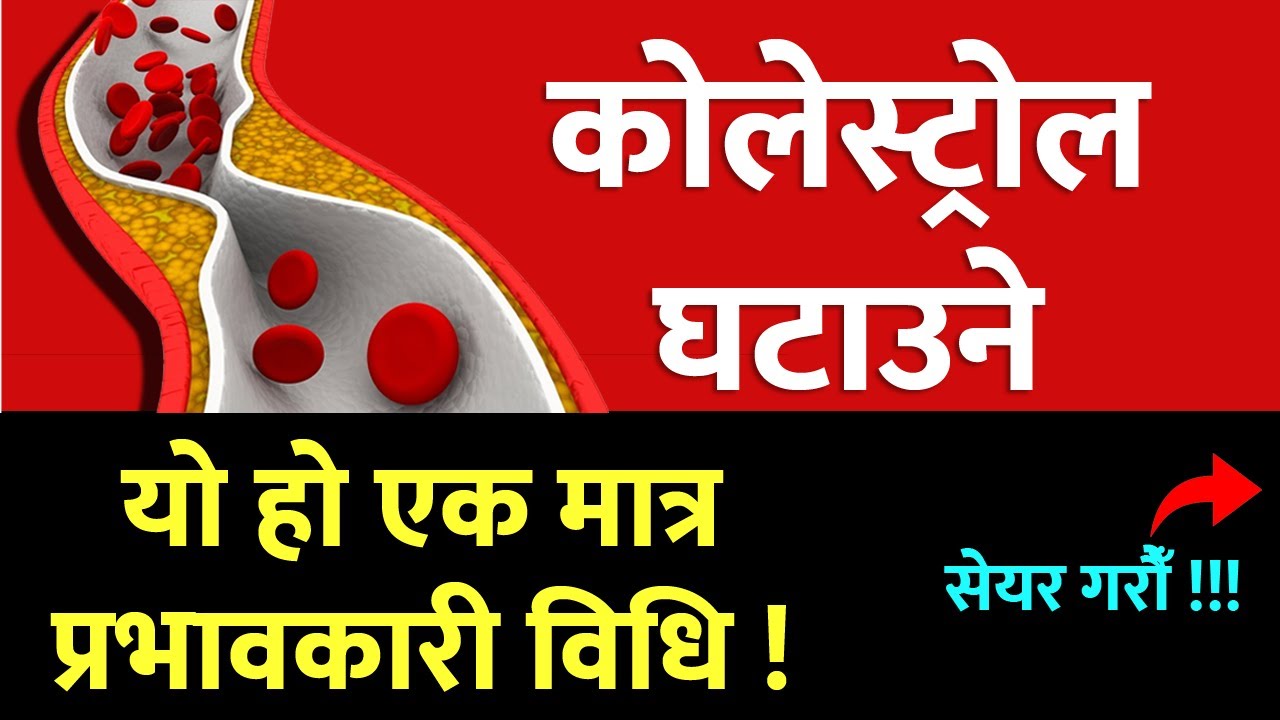 कोलेस्ट्रोल घटाउने प्रभावकारी तरिका जान्नुहोस् (Cholesterol Symptoms Nepali)