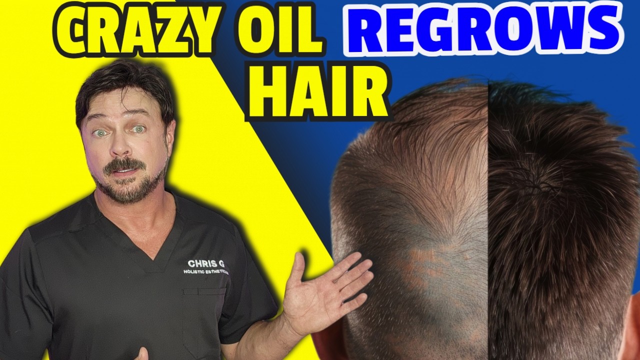 Botanical Oil Now PROVEN To Regrow Hair