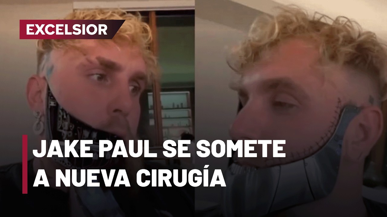 Nueva cirug&iacute;a de mand&iacute;bula para Jake Paul