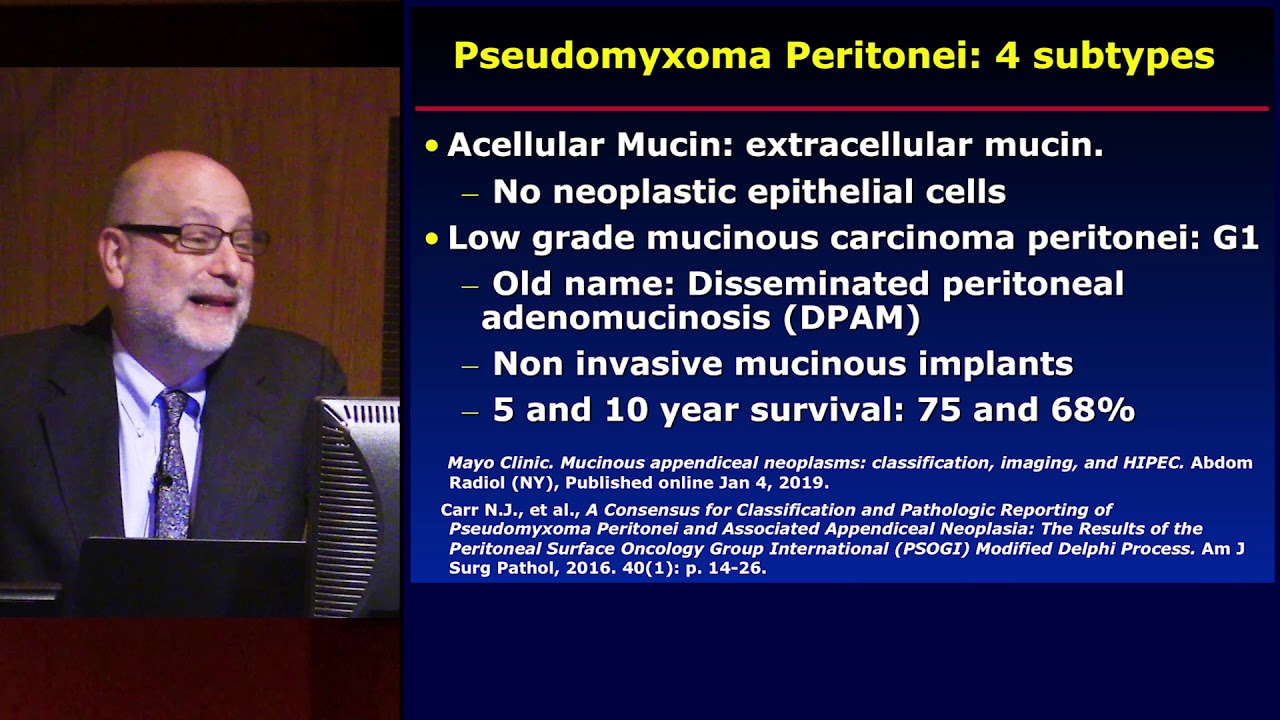 Dr. Siegelman on Imaging of the Peritoneum and Appendiceal Neoplasms