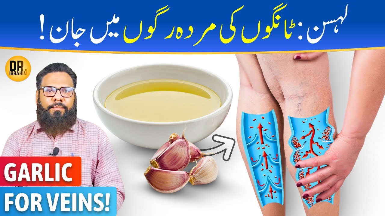 Lehsan Juice Ke Fayde | Varicose Veins/Tangon Ki Nasen Ka Ilaj | Dr. Ibrahim