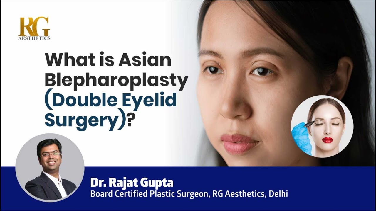 What is Asian Blepharoplasty(Double Eyelid Surgery)? Dr Rajat Gupta -Board Certified Plastic Surgeon