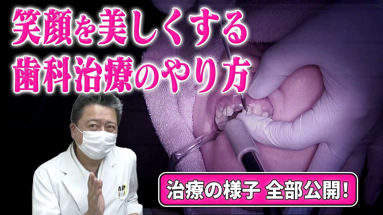 【審美】治療風景公開！歯を美しくして人生を変える！