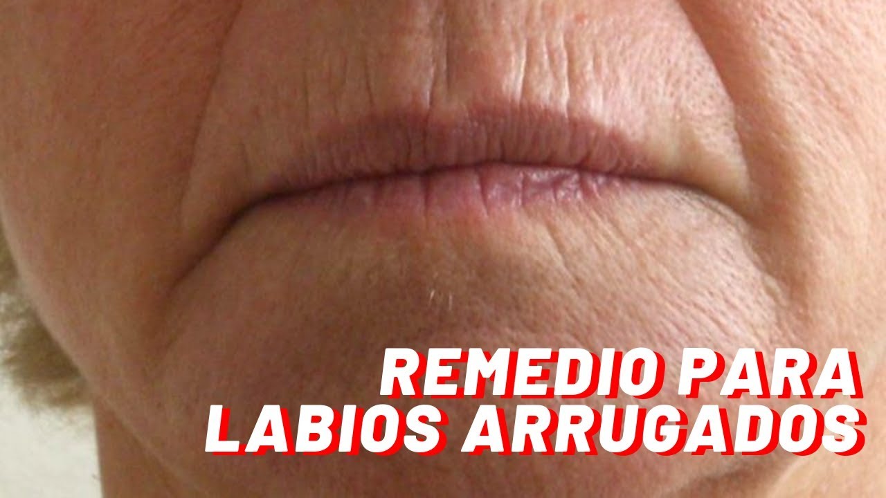 REMEDIO PARA ARRUGAS DEL CONTORNO DE LABIOS | ADRIANA VIEIRA
