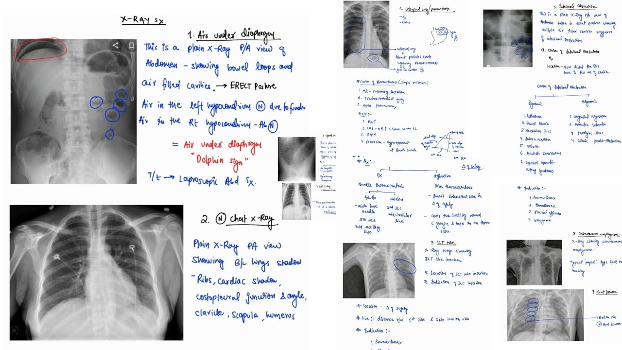 SURGERY X RAY  | PRACTICAL | VIVA | SURGERY | 4TH PROFF | MBBS