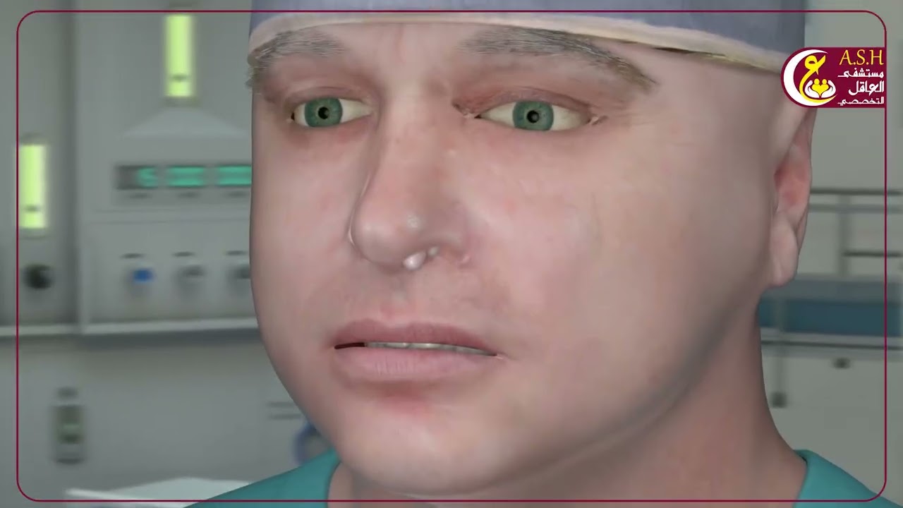 التهاب الجيوب الأنفية المزمن