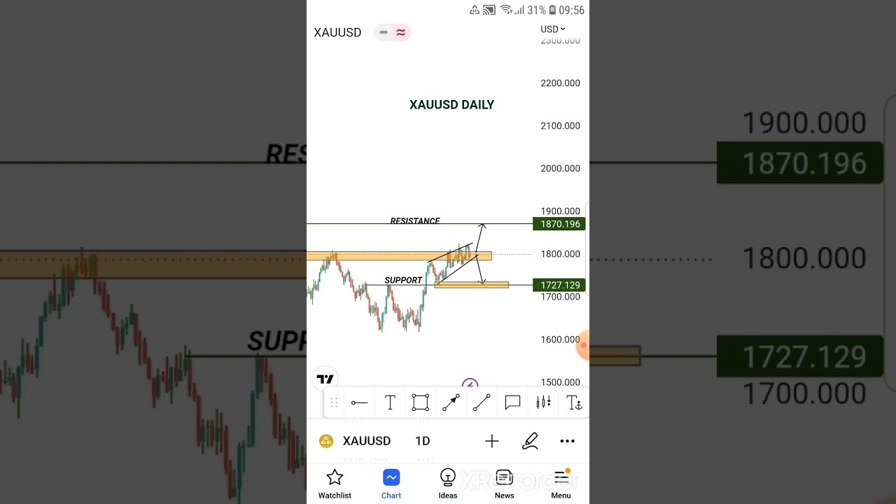 XAUUSD Daily Forecast #7