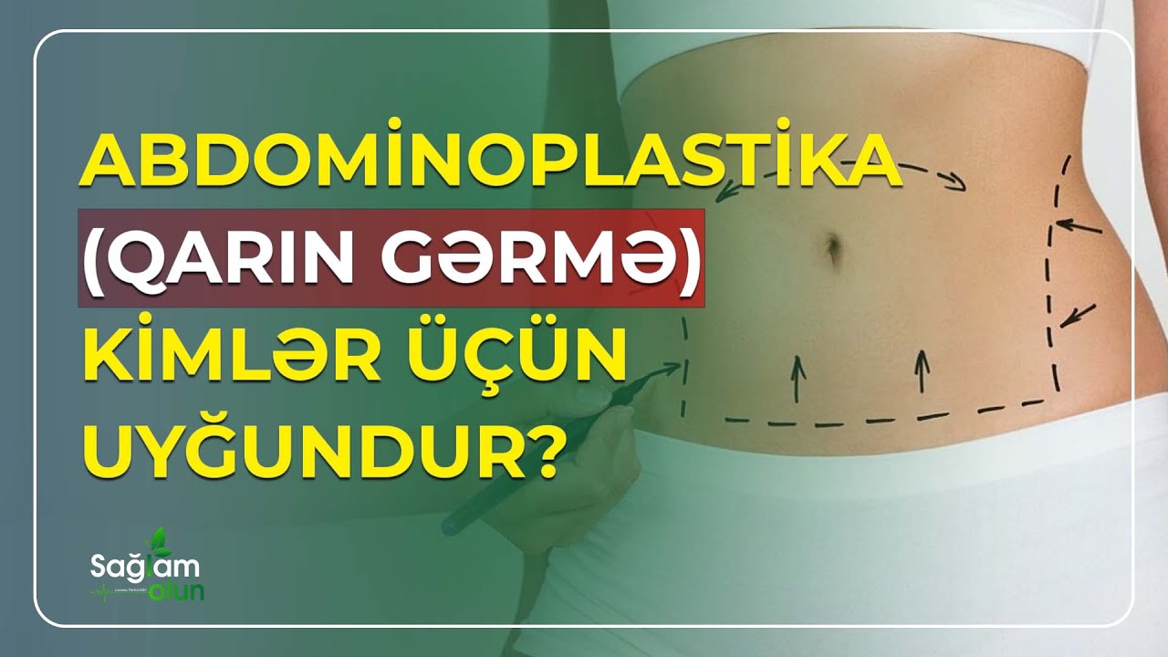 ABDOMİNOPLASTİKA (QARIN GƏRMƏ) ƏMƏLİYYATINDAN SONRA NƏ ZAMAN CİNSİ ƏLAQƏ OLAR? - SAĞLAM OLUN (05.07)