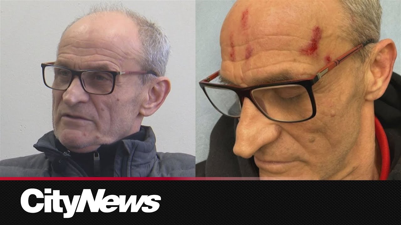 “This was targeted.” Search is on for suspects who attacked Markham fencing coach