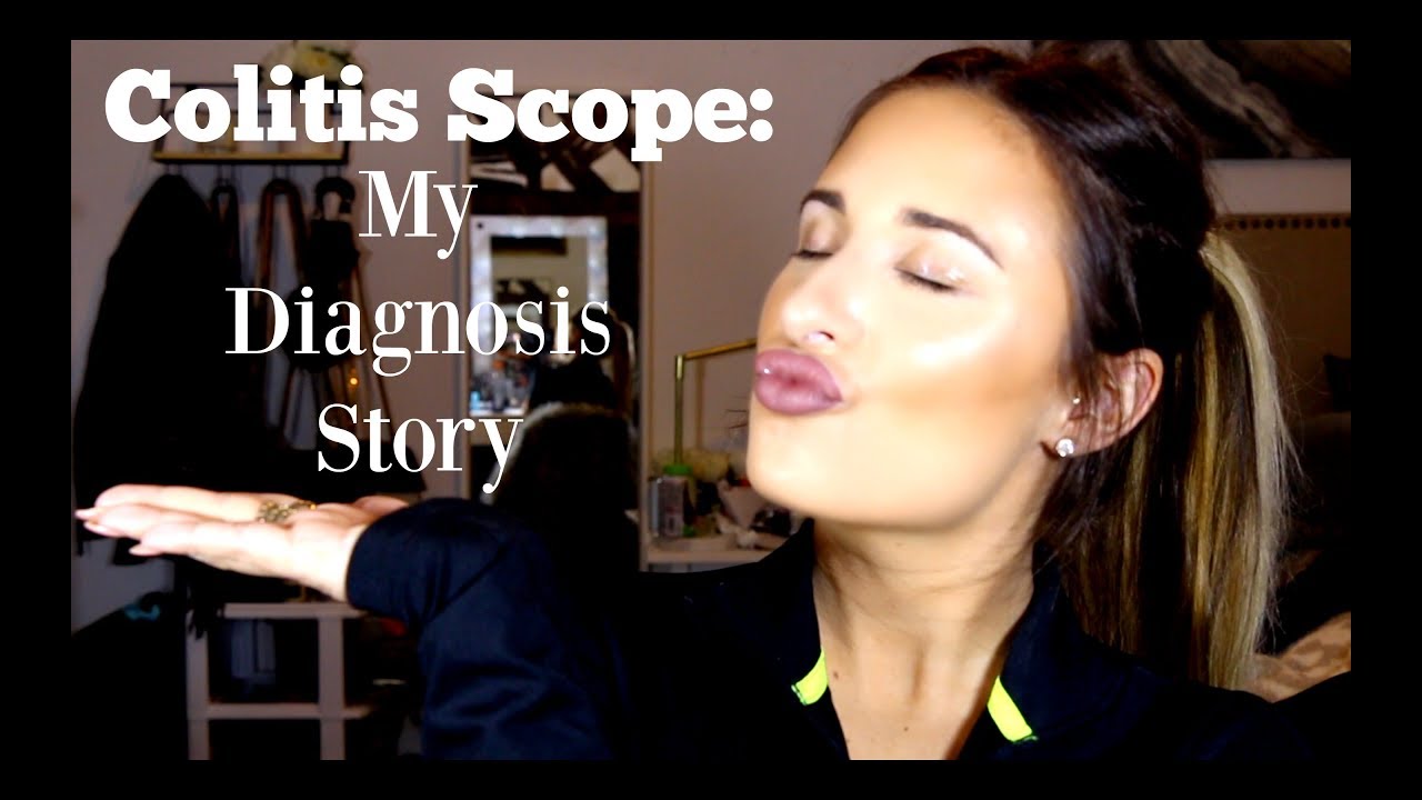 COLITIS SCOPE: MY ULCERATIVE COLITIS DIAGNOSIS STORY! | LIVING WITH ULCERATIVE COLITIS