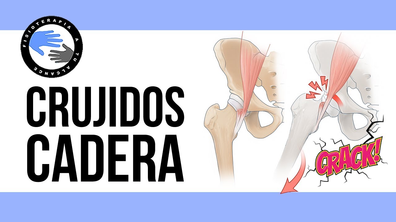 ¿Tienes crujidos en la cadera? prueba estos 3 ejercicios para trabajar la estabilidad