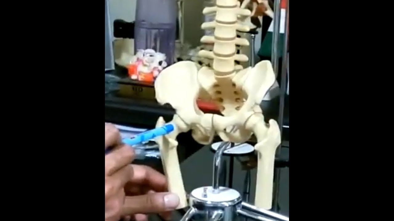 Leg length after Hip Replacement and Pelvic Tilt
