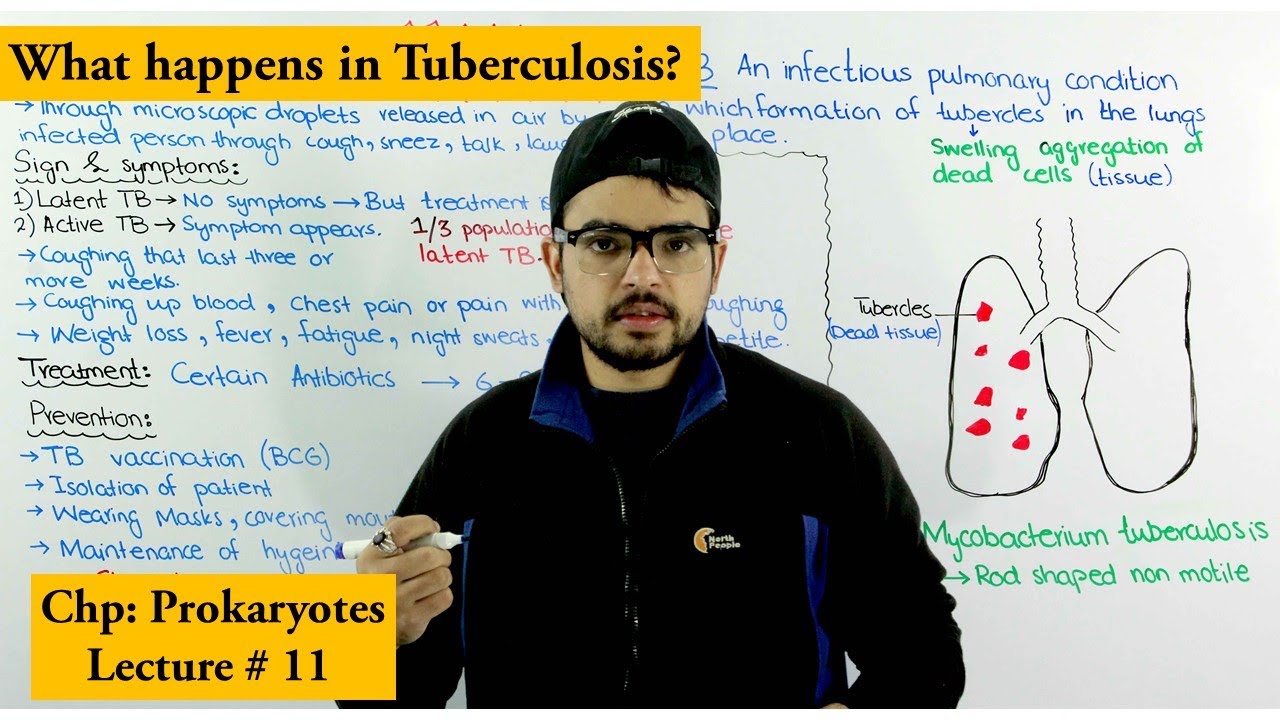 Tuberculosis (TB) | Causes, Treatment, Prevention and Transmission