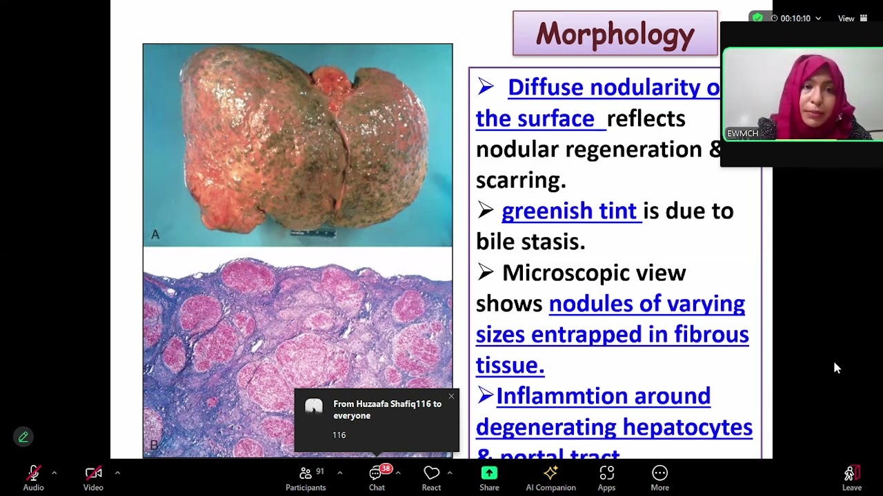 Pathology Lecture (11.08.2024) by Dr. Faiza Nusrat Ma'am