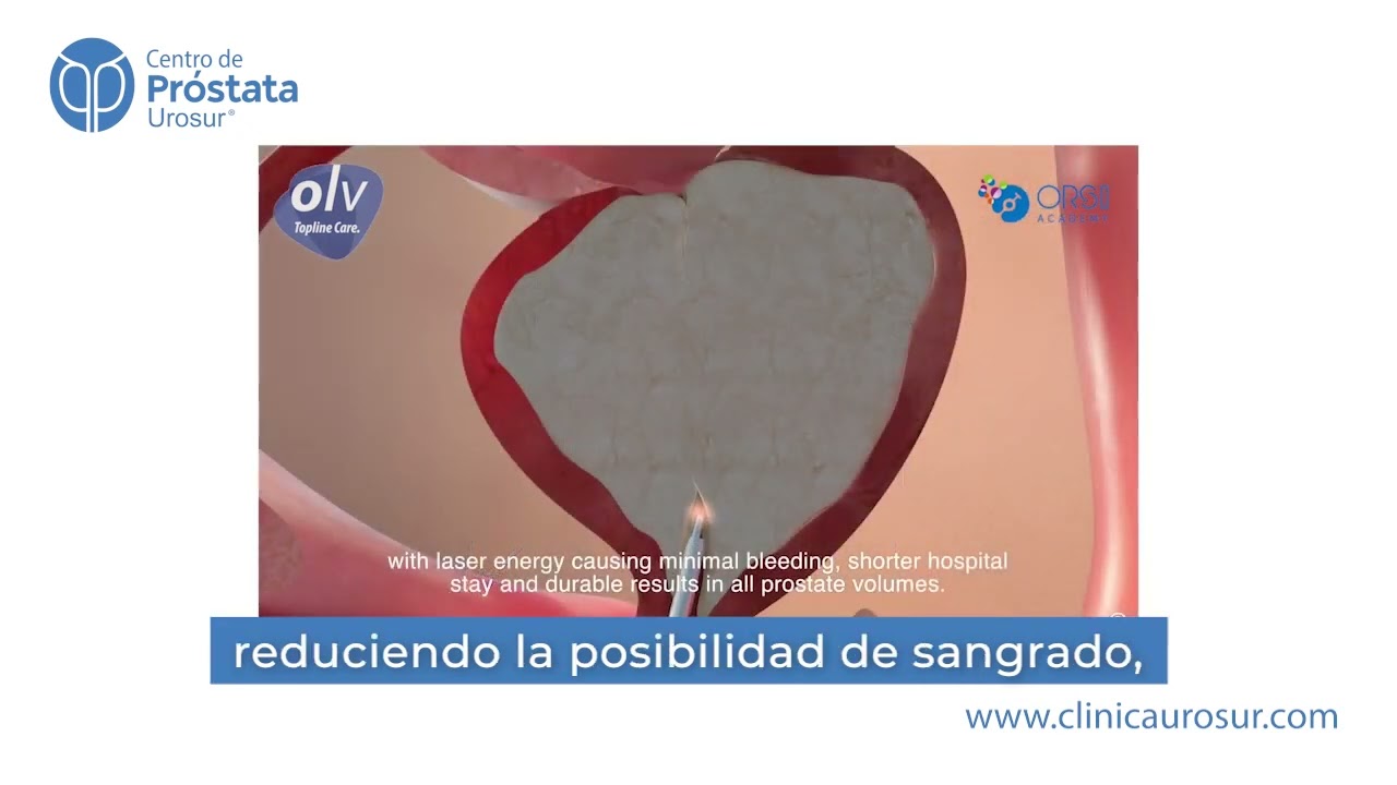 Cirug&iacute;a l&aacute;ser para tratamiento de crecimiento prost&aacute;tico (HPB)