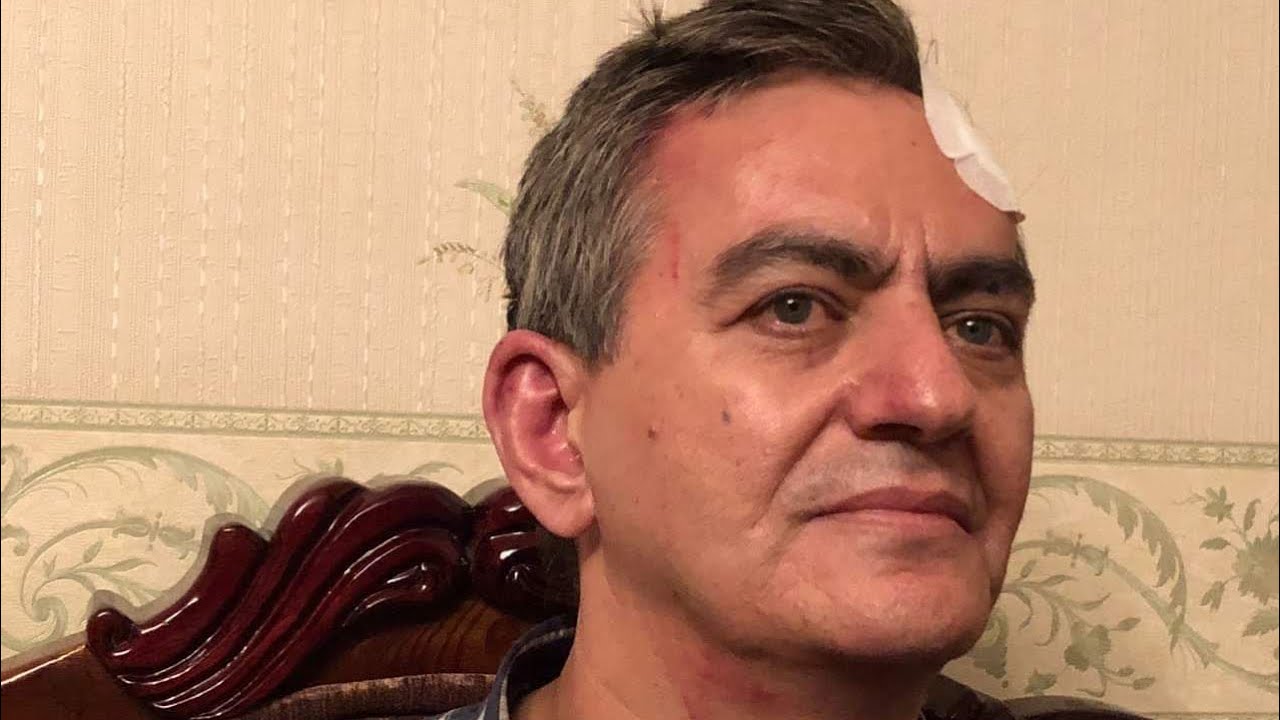 Əli Kərimli sərbəst buraxılandan sonra ona verilən işgəncələrdən danışır