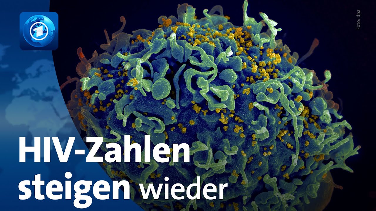 HIV: 1,5 Millionen Neuinfektionen