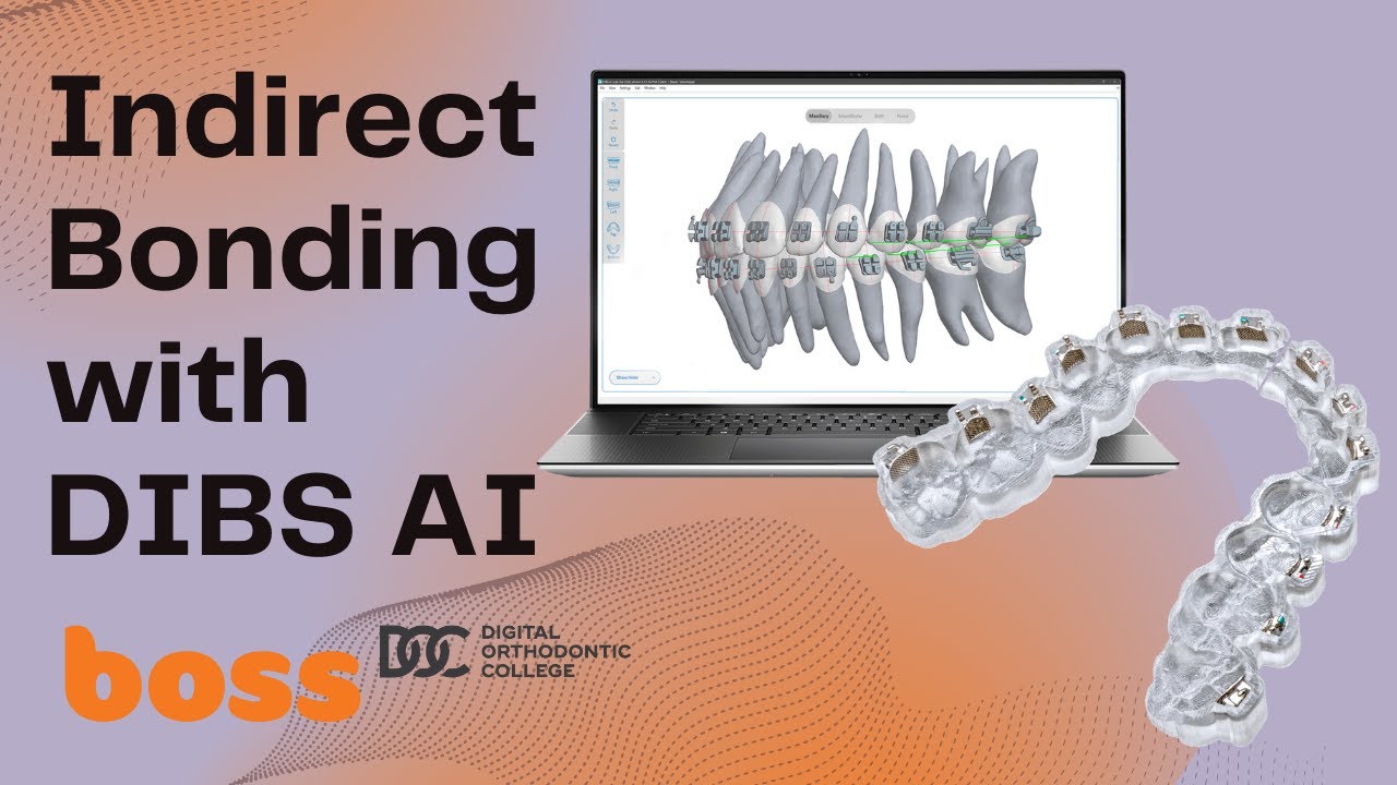 3D planning and printing of Indirect Orthodontic Bonding (IDB) trays with DIBS AI