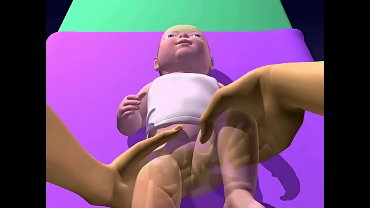 Maniobras de Barlow y Ortolani (Exploración del niño con displasia del desarrollo de cadera)